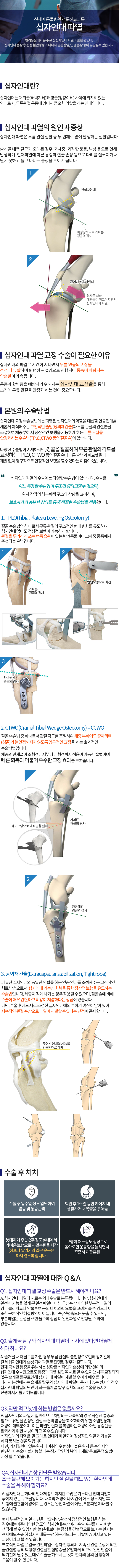 십자인대파열