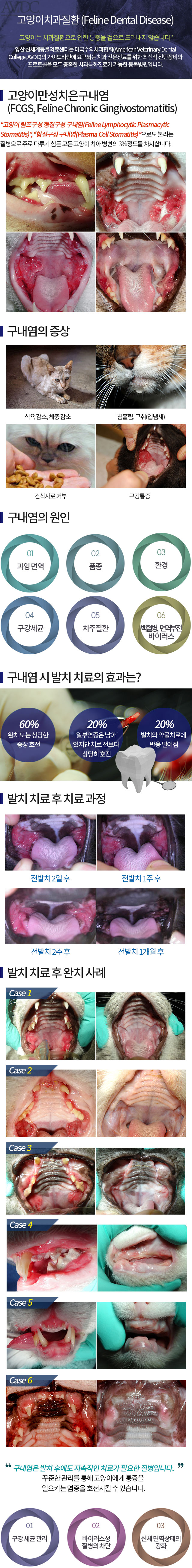 만성치은 구내염