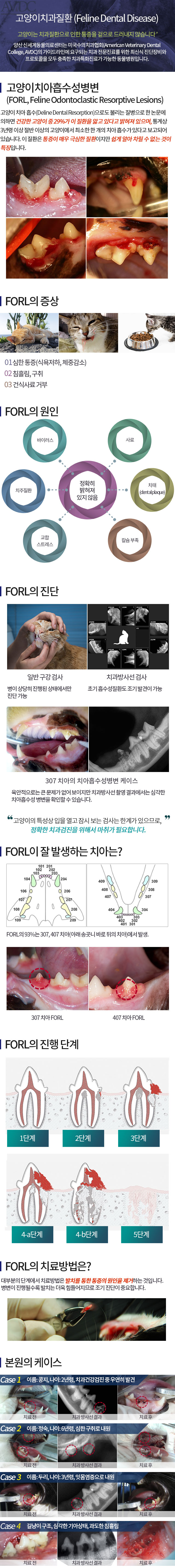 치아흡수성병변