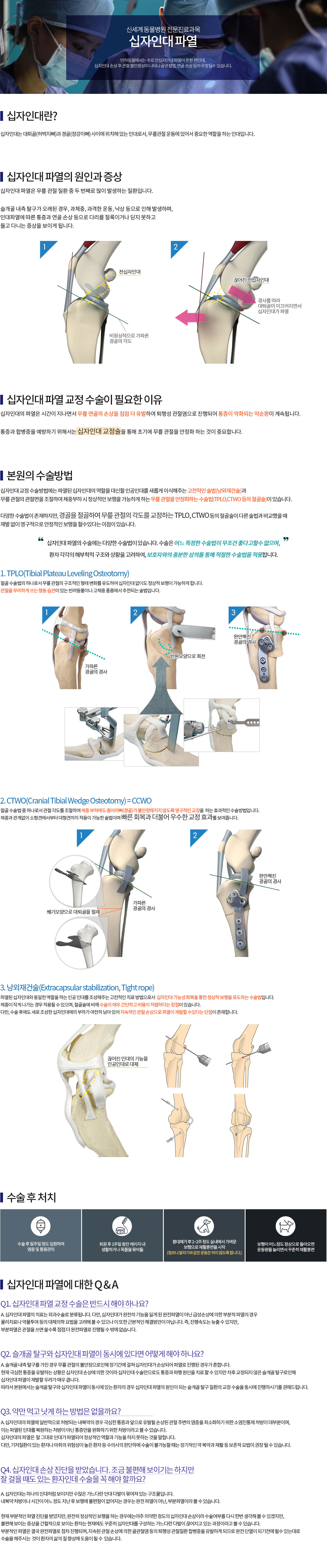 십자인대파열