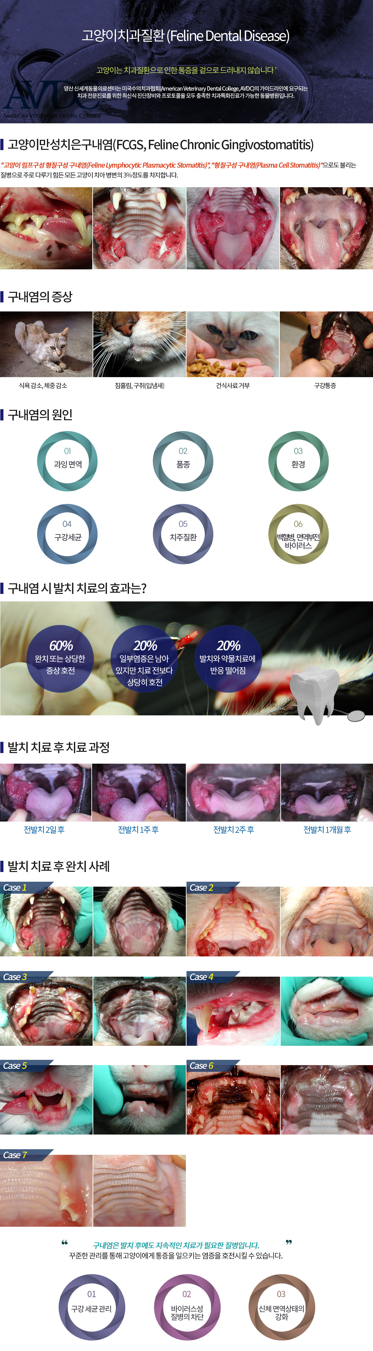 만성치은 구내염